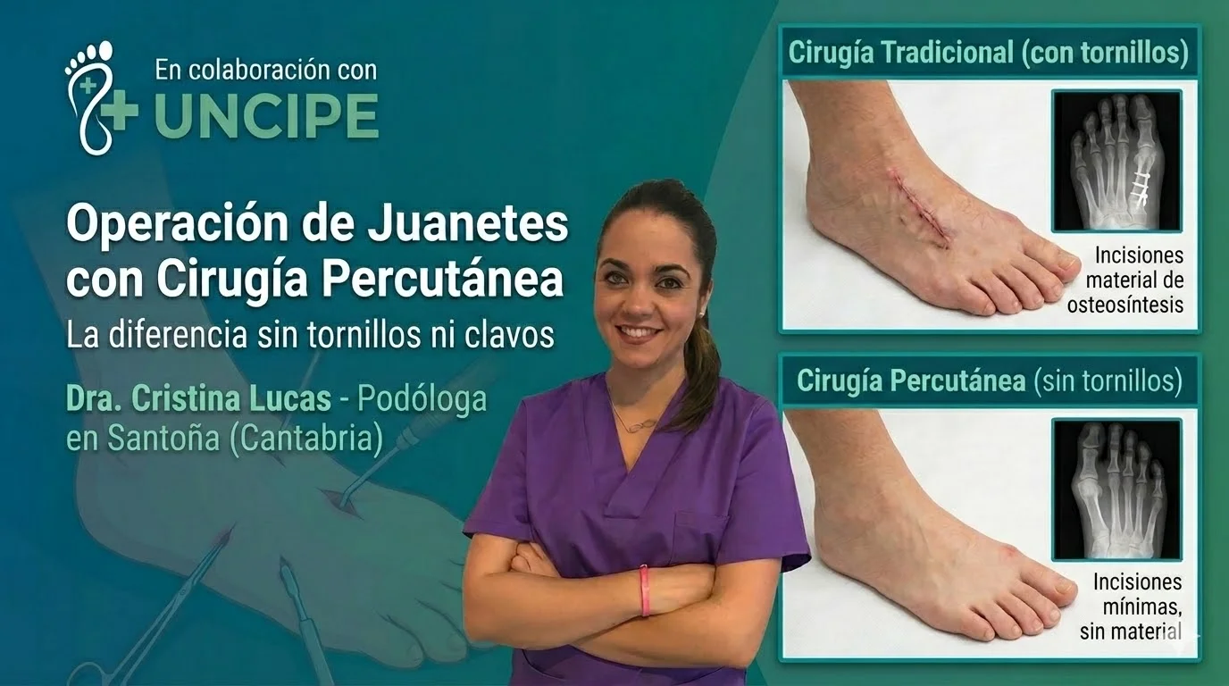 Operación de Juanetes con Tornillos y Clavos: Riesgos, Recuperación y la Alternativa Sin Dolor